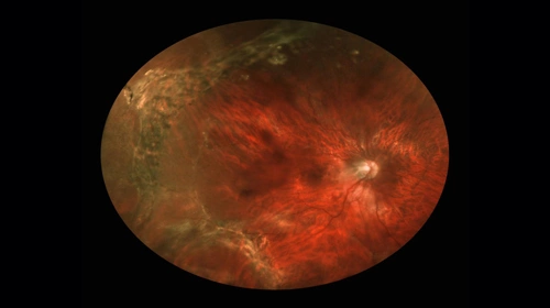 Tại sao con người lại nổ đom đóm mắt - Báo VnExpress