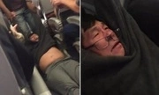 Lý do United Airline cần 4 chỗ và đuổi bác sĩ gốc Việt là rất vô lý