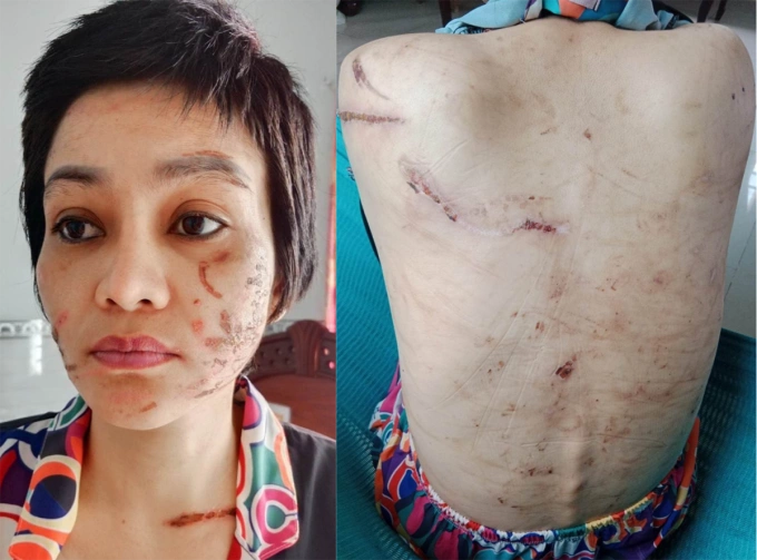 Chị Bùi Thị Tuyết Giao khi chạy trốn về nhà cha mẹ. Ảnh: Gia đình cung cấp