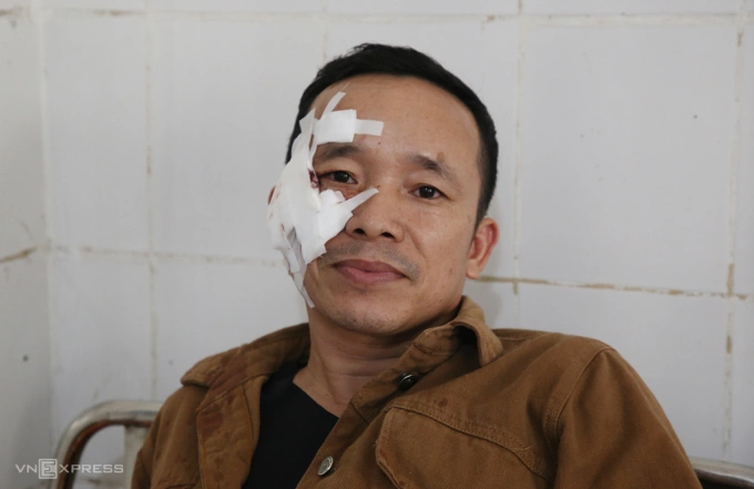Anh Lê Văn Phước bị băng bó gần nửa phần mặt, nói may mắn thoát chết. Ảnh: Đắc Thành