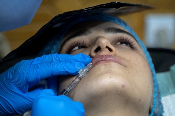 Một khách hàng nữ tiêm chất làm đầy môi trong phòng khám thẩm mỹ ở Kabul, thủ đô Afghanistan, ngày 13/8. Ảnh: AFP