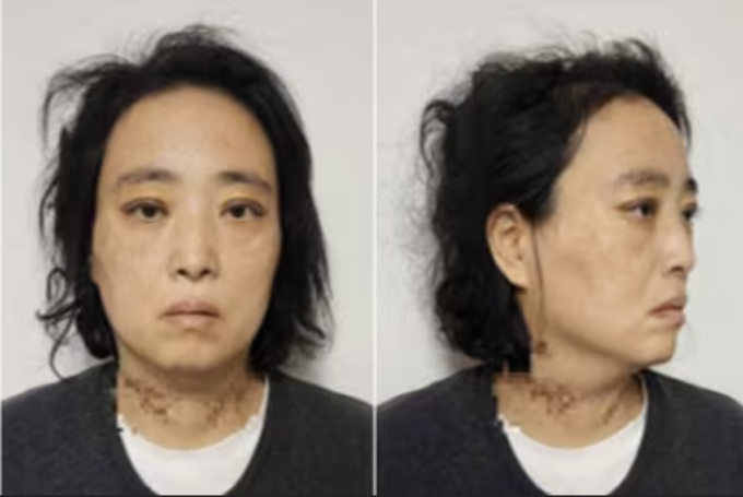 Myeong Jae-wan khi bị bắt, tháng 3/2024. Ảnh: Chosun Daily