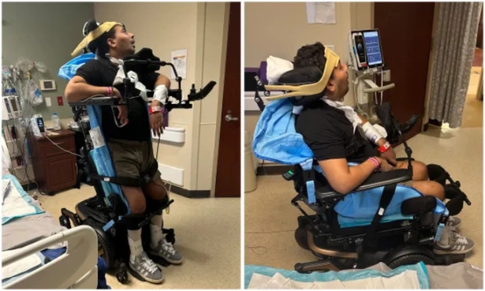 Nạn nhân Patel điều trị phục hồi chức năng tại bệnh viện. Ảnh: NY Daily News