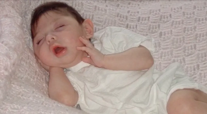 Alex Simpson hồi mới chào đời. Ảnh: NYP