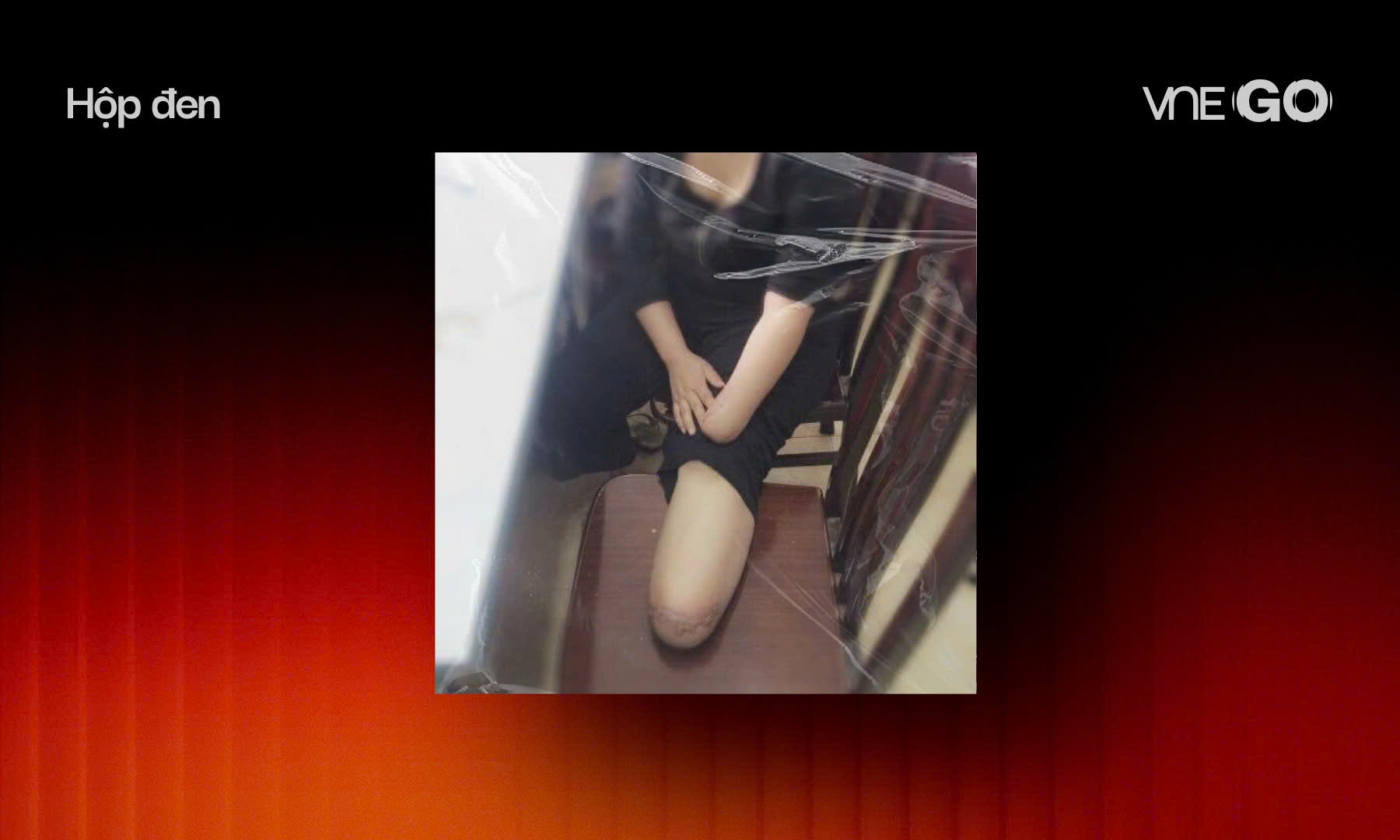 Kịch bản kinh hoàng tự chặt tay chân để trục lợi bảo hiểm Kịch bản kinh hoàng tự chặt tay chân để trục lợi bảo hiểm