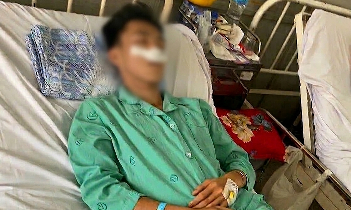 Nam sinh lớp 11 bị bạn đánh gãy xương mũi