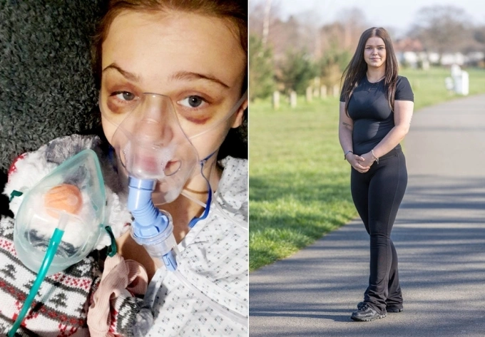 Bobbie Goodman bị chấn thương nặng sau vụ hành hung năm 2022, hiện vẫn còn di chứng về sức khỏe và tâm lý. Ảnh: SWNS