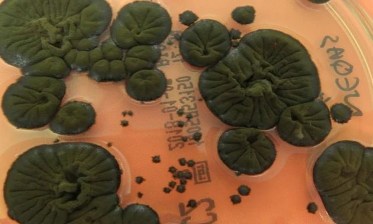 C. sphaerospermum fungus contains melanin. Photo: (Rui Tomé/Atlas of Mycology