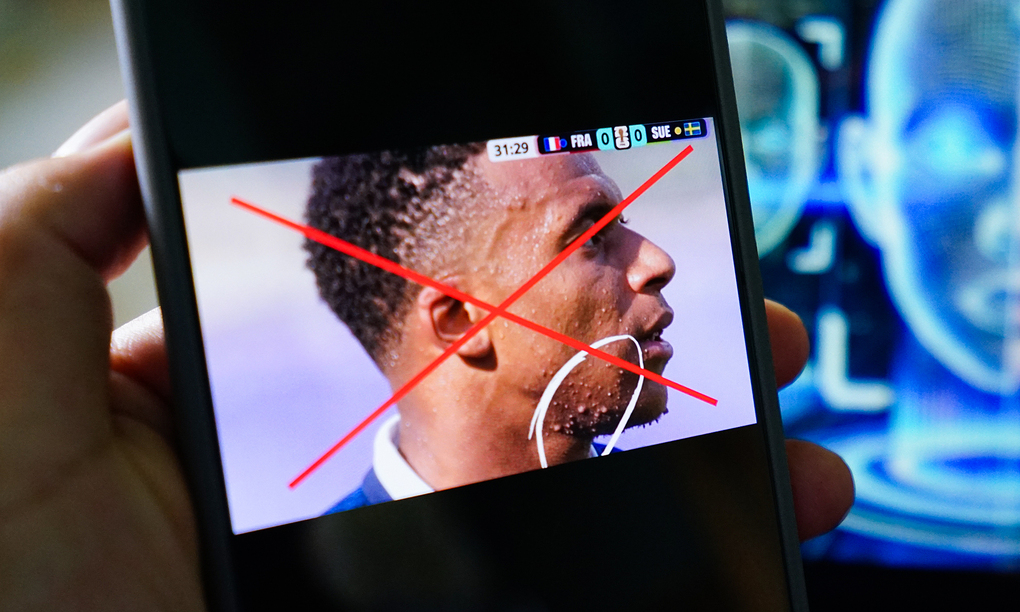 The photo of Kylian Mbappé having strange acne was confirmed to be fake. Photo: Twitter/DR