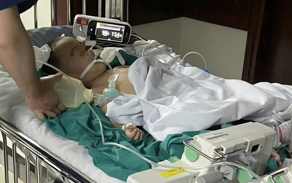 Bé trai nghi bị bạo hành tử vong